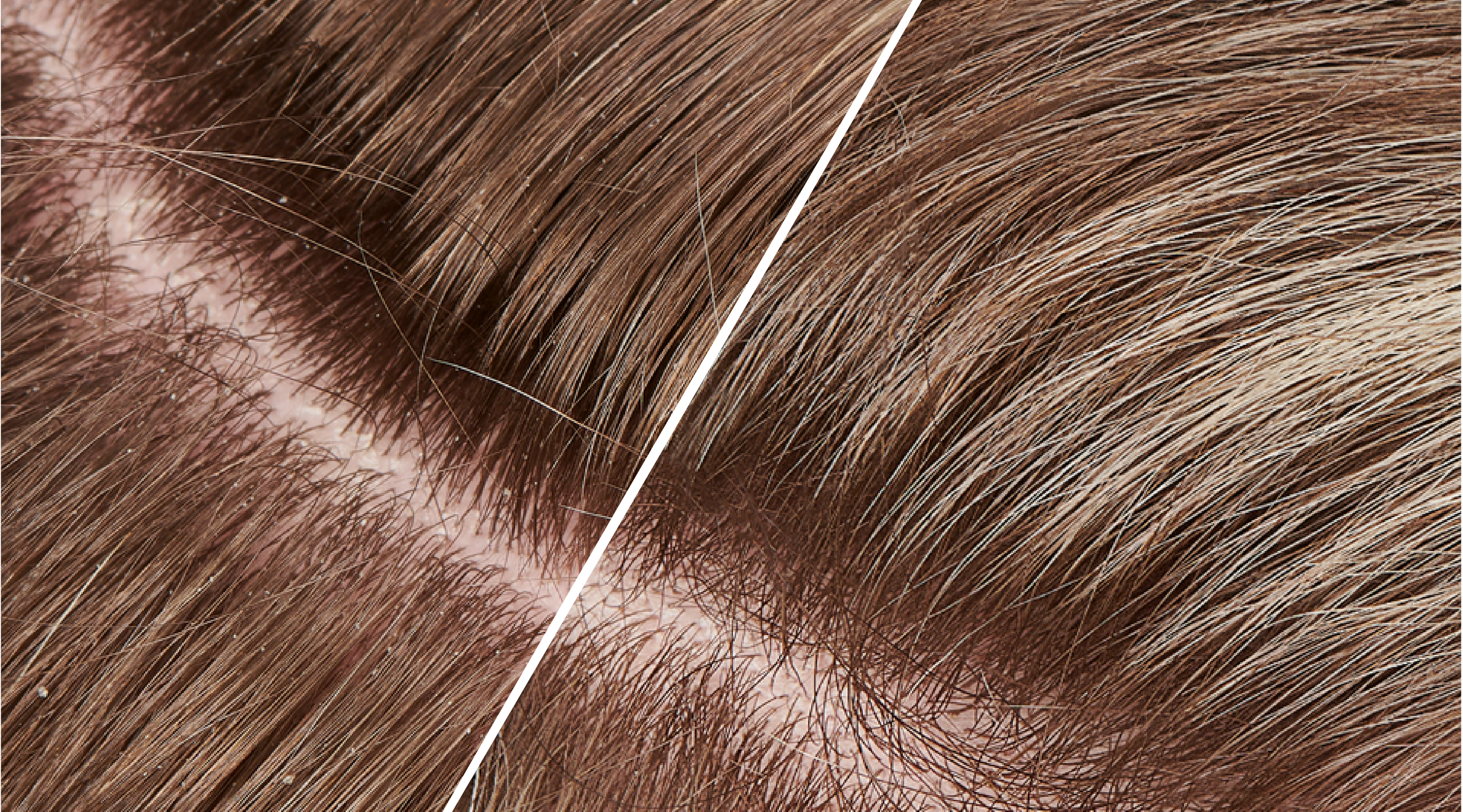 Top 3 Reasons Your Scalp Care Routine Needs to Work Like Your Skincare Routine