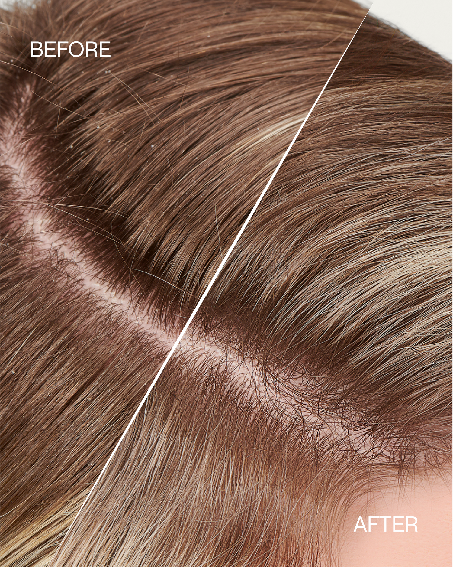 Top 3 Reasons Your Scalp Care Routine Needs to Work Like Your Skincare Routine