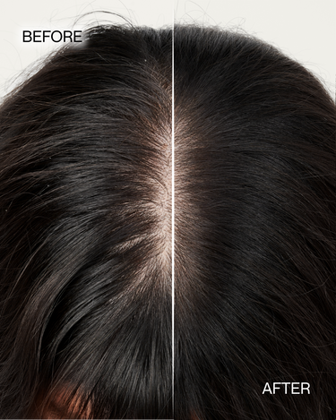 S.2 RENEW by Nutrire